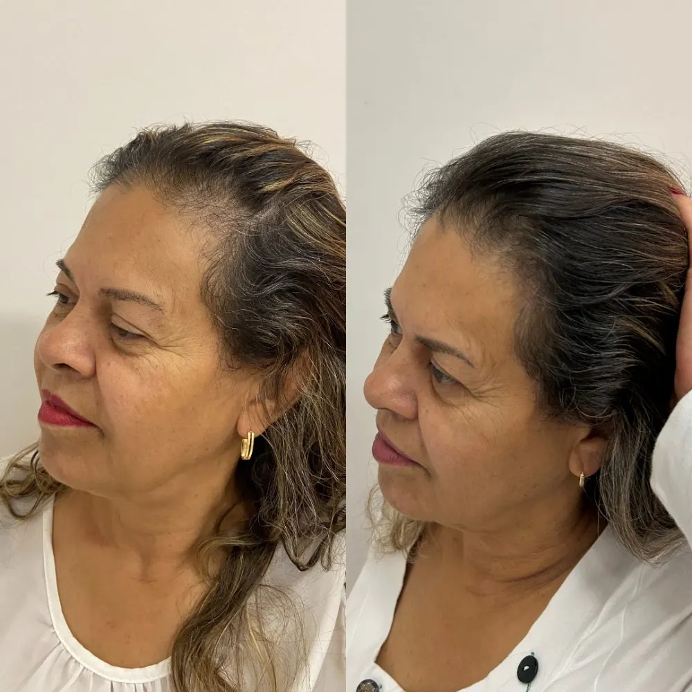 Antes e depois de tratamento capilar na Cute & Capelli