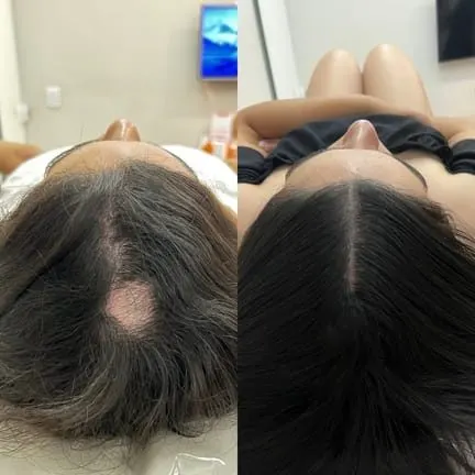 Antes e depois de tratamento capilar na Cute & Capelli
