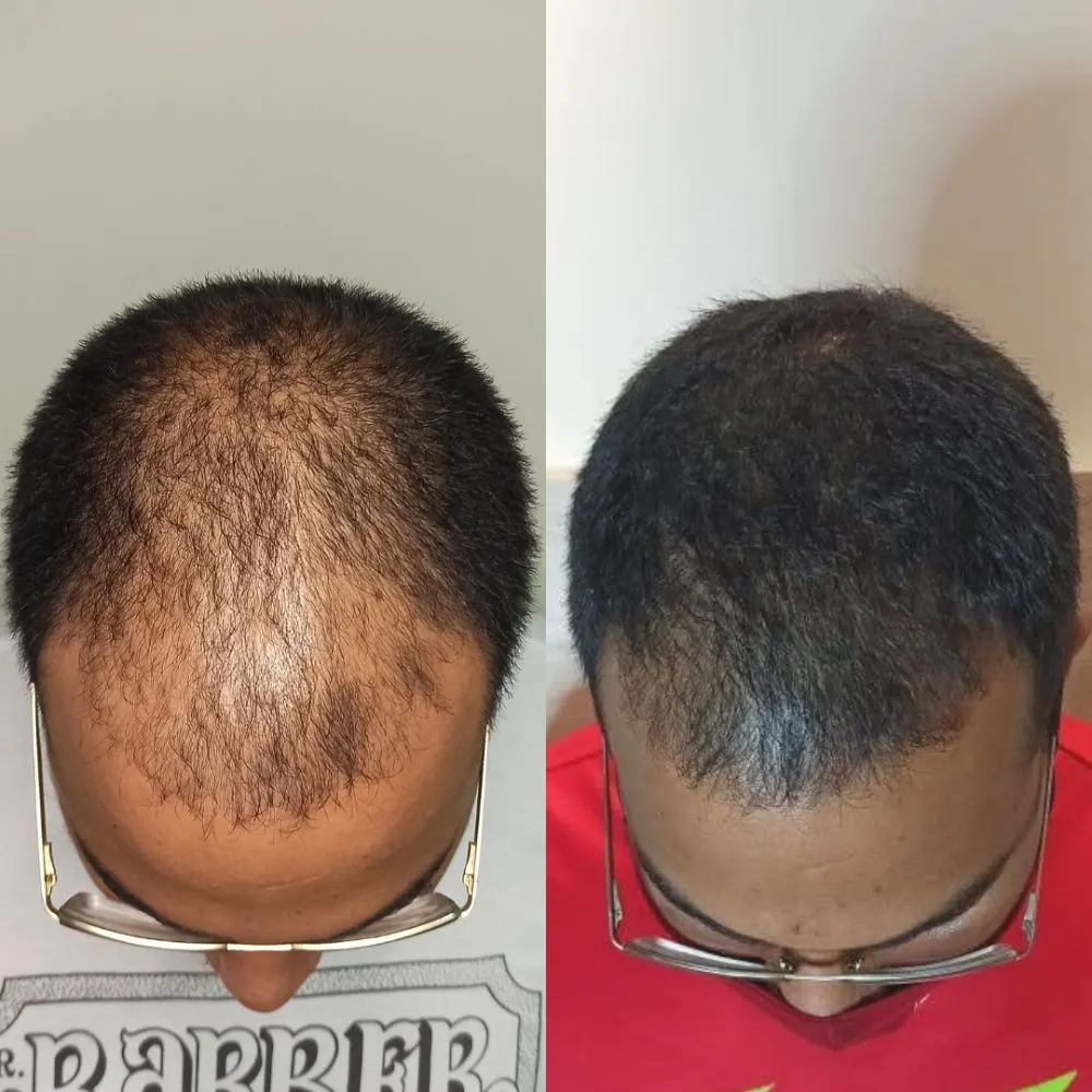 Antes e depois de tratamento capilar na Cute & Capelli