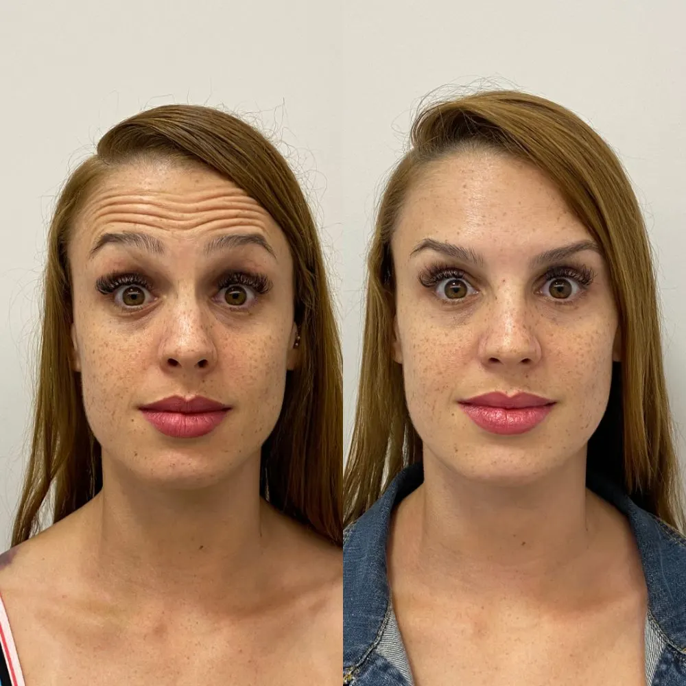 Antes e depois de tratamento facial na Cute & Capelli
