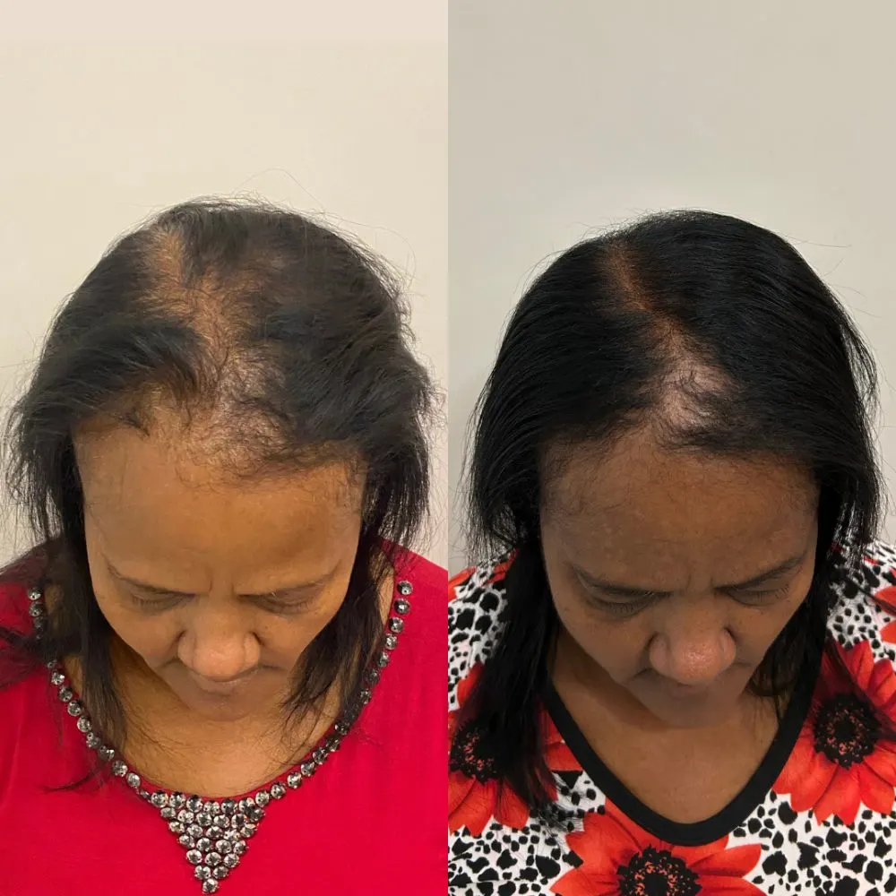 Antes e depois de tratamento capilar na Cute & Capelli