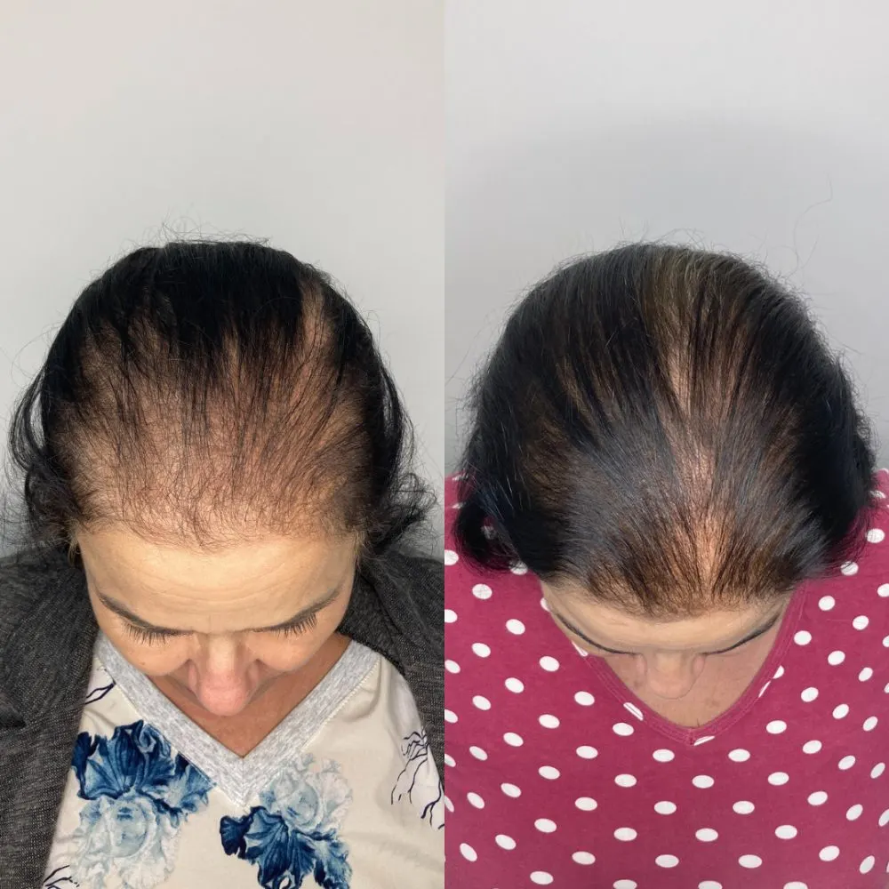 Antes e depois de tratamento capilar na Cute & Capelli