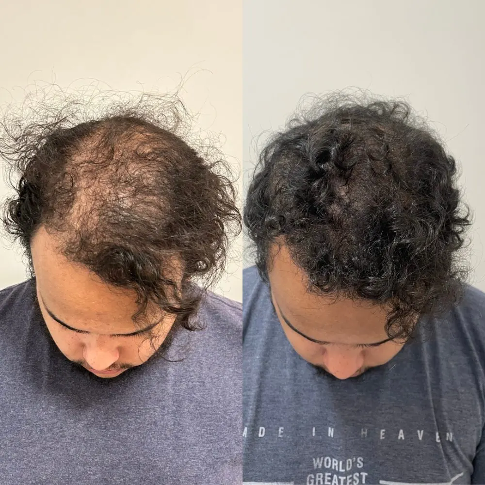 Antes e depois de tratamento capilar na Cute & Capelli