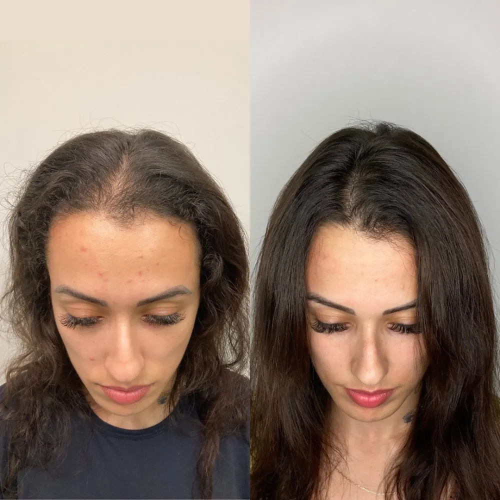 Antes e depois de tratamento capilar na Cute & Capelli