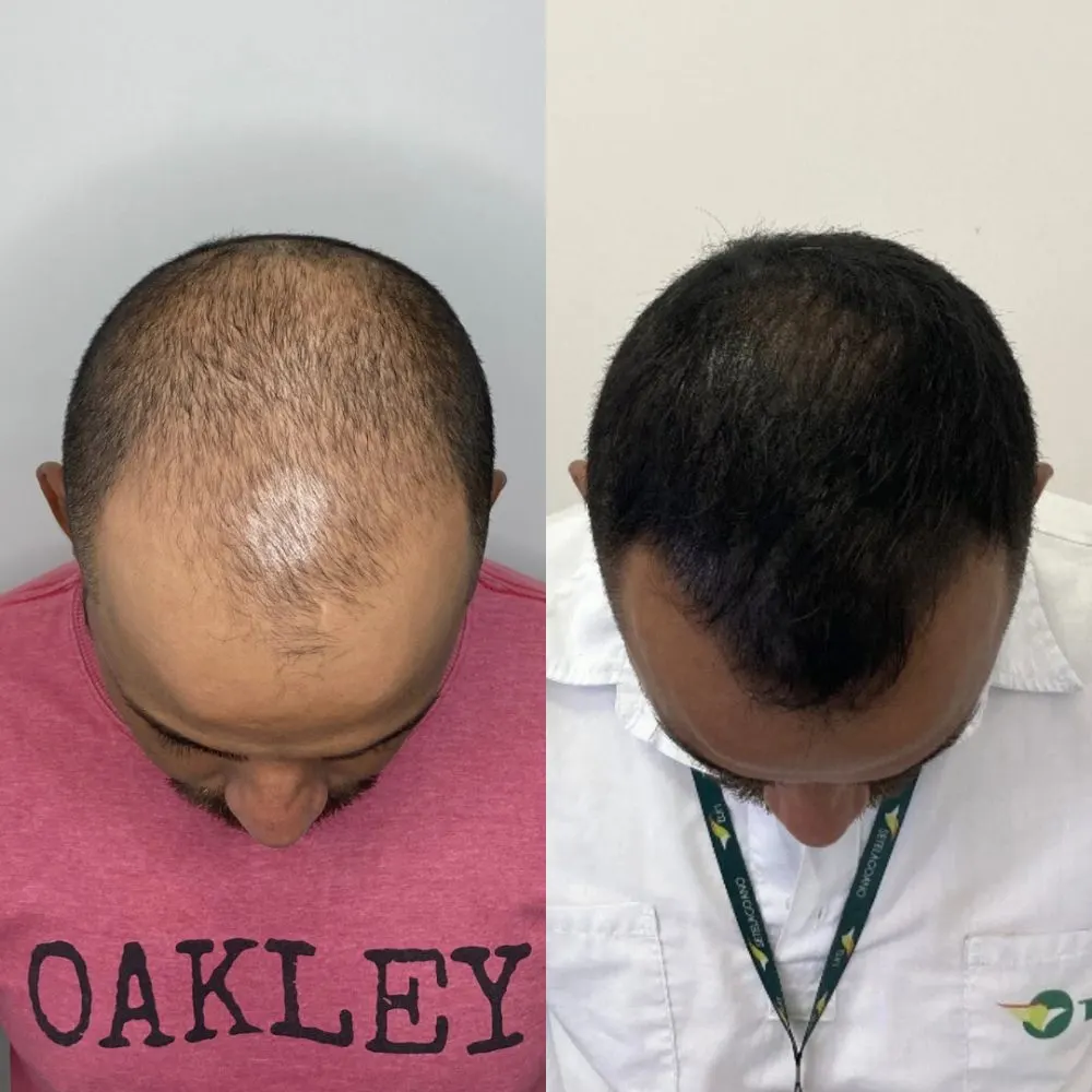 Antes e depois de tratamento capilar na Cute & Capelli