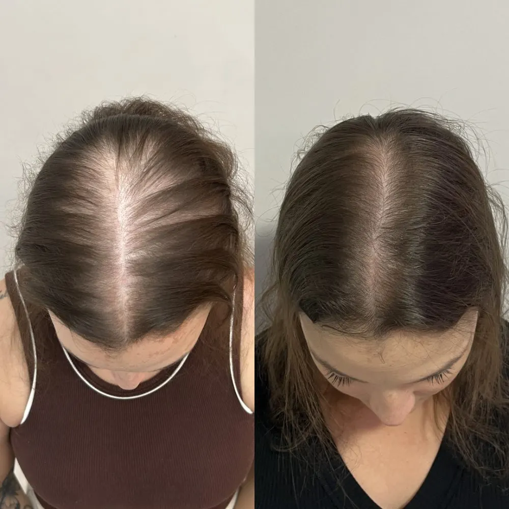 Antes e depois de tratamento capilar na Cute & Capelli
