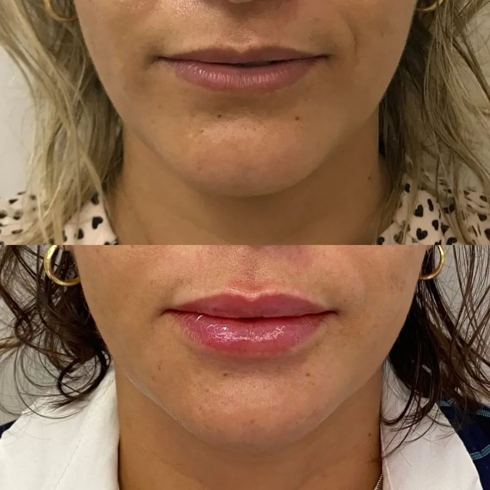 Antes e depois de tratamento facial na Cute & Capelli