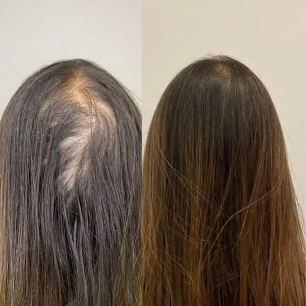 Antes e depois de tratamento capilar na Cute & Capelli