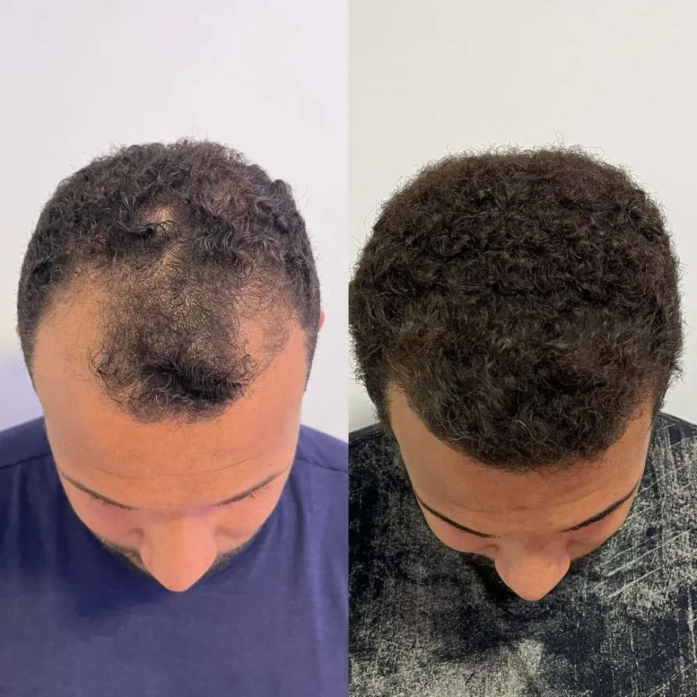 Antes e depois de tratamento capilar na Cute & Capelli